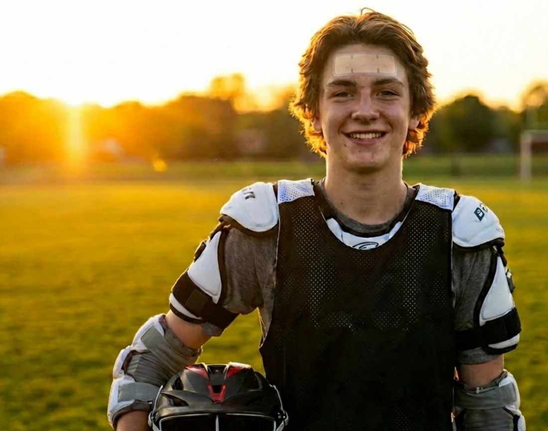 Helmet Acne: Why Football & Hockey Players Break Out Under Their Gear (and how to stop it)