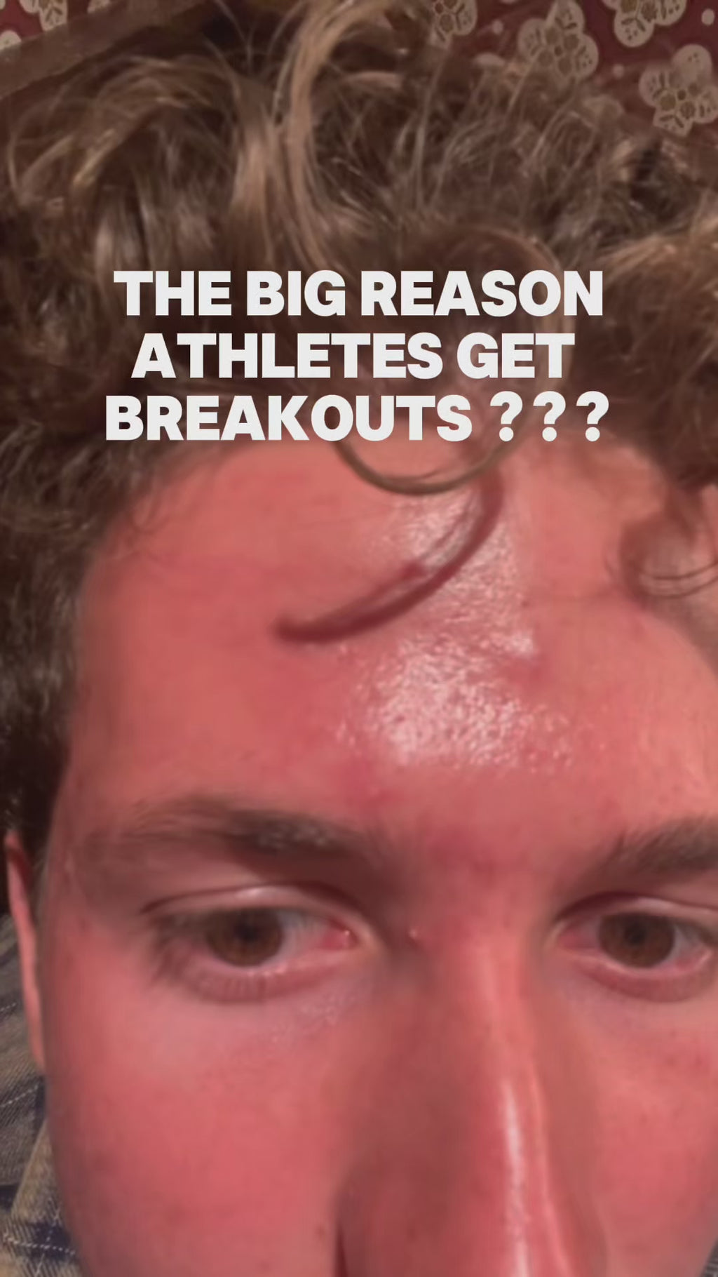 Anti-Acne Sports Patch