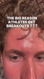 Anti-Acne Sports Patch